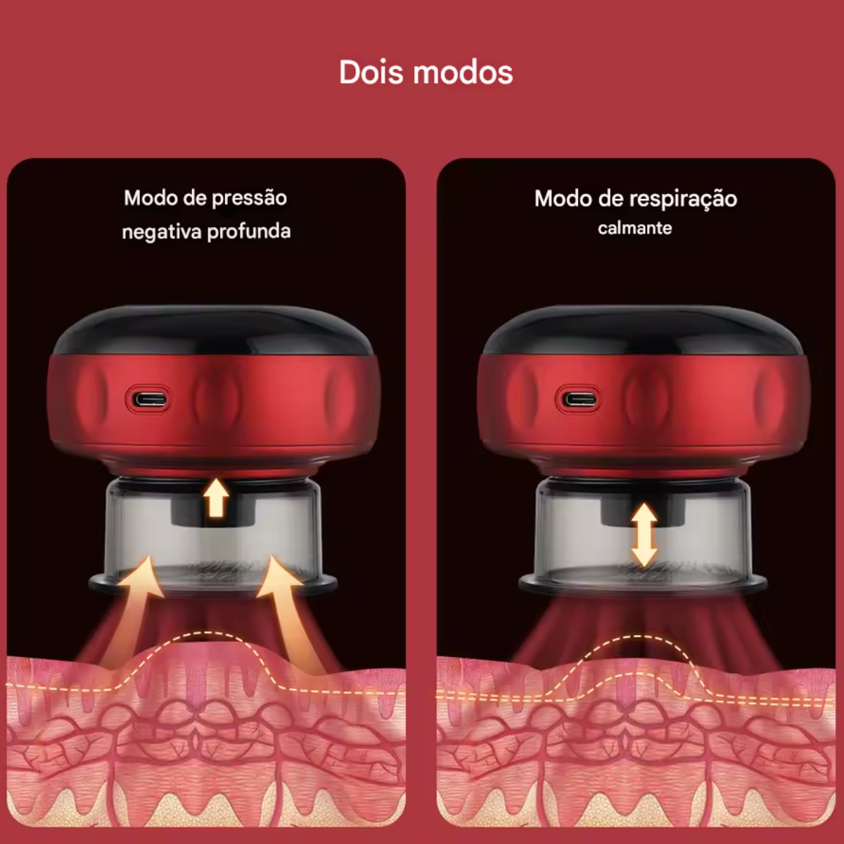 Atacado | Máquina de Ventosaterapia Elétrica Smart Cupping com Aquecimento e Luz Vermelha