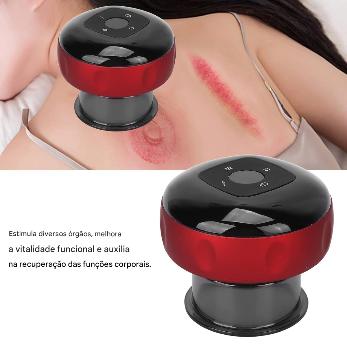 Atacado | Máquina de Ventosaterapia Elétrica Smart Cupping com Aquecimento e Luz Vermelha